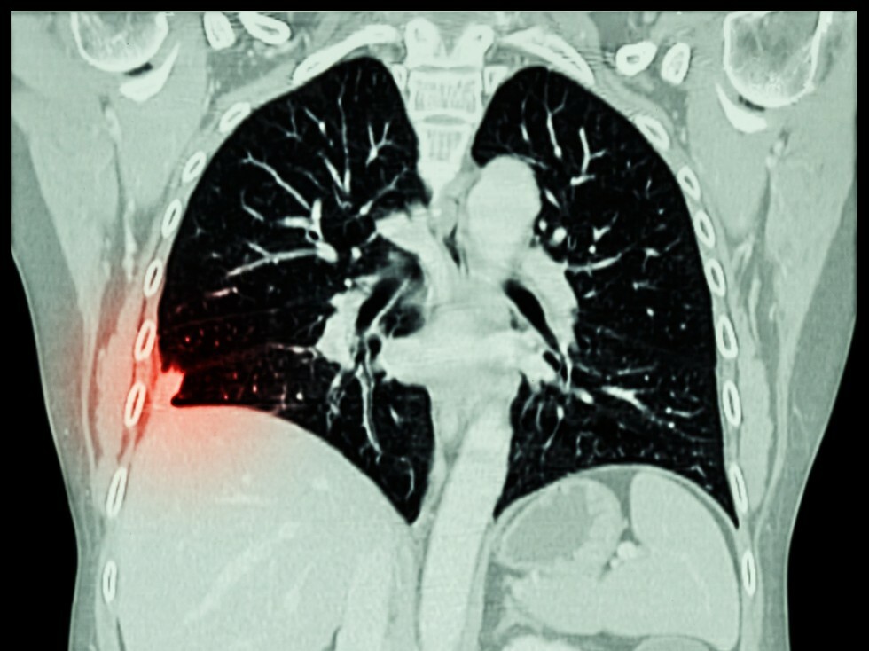 chest x-ray